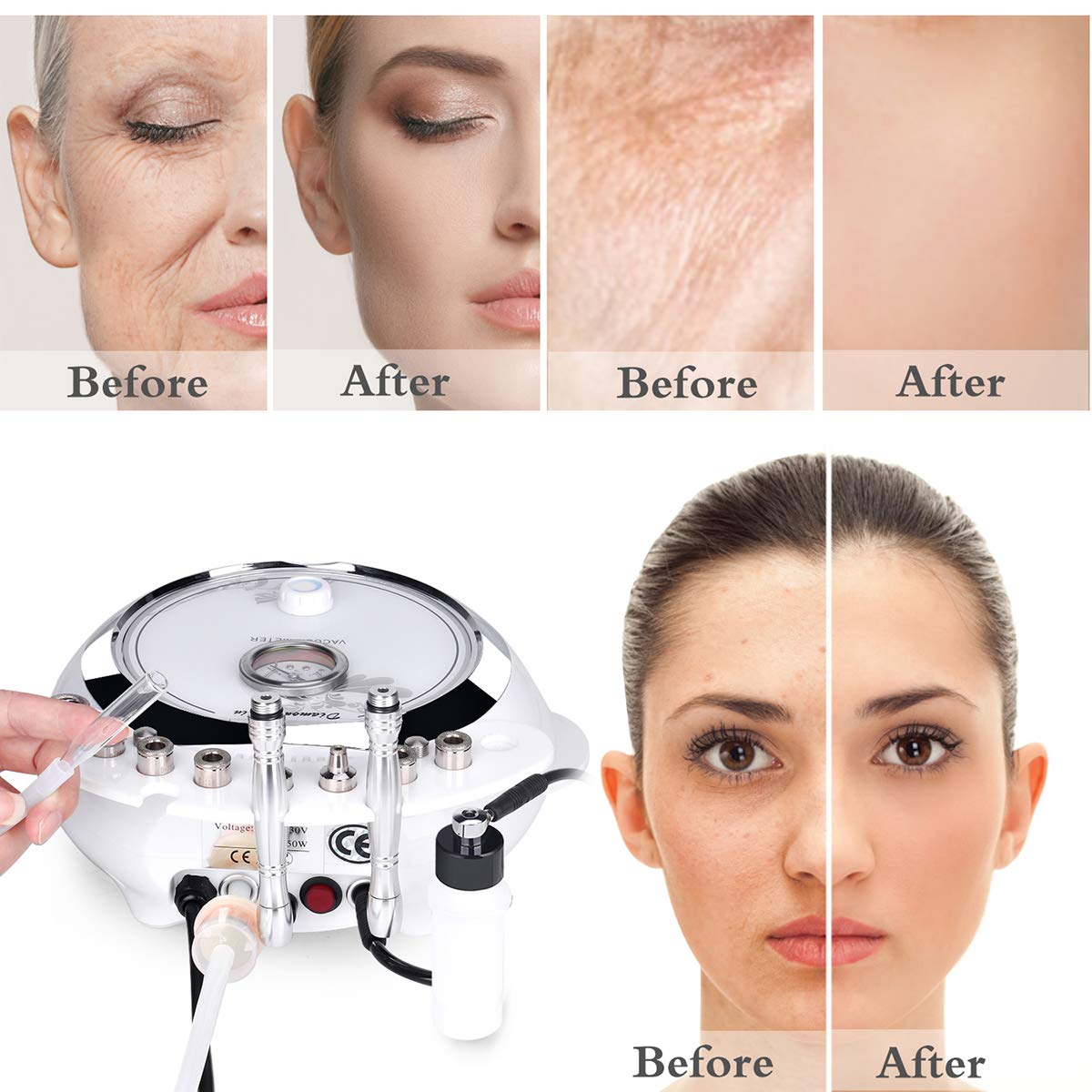 Professional Diamond Microdermabrasion Machine for Home Using